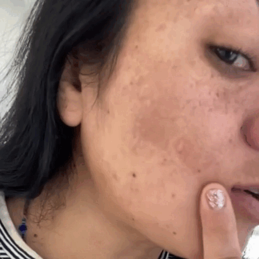 BREYLEE® Serum de Retinol Quita Manchas – Homexpress