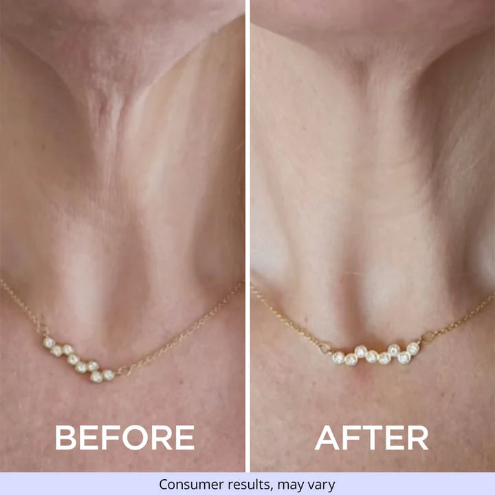 NeckGlow®-Crema Reafirmante para cuello