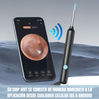 SmartClean® Limpiador de oídos con cámara + Kit de accesorios gratis