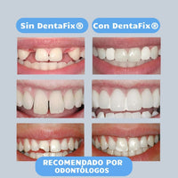 DentaFix® Arregla tus Dientes para una Sonrisa Perfecta