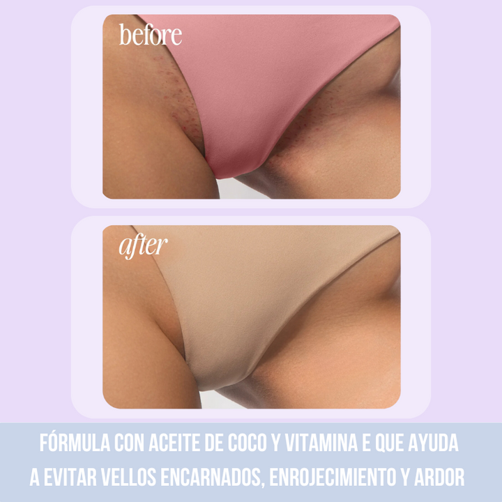 Truly Glazed Donut™ Aceite para Zona Intima con Aroma