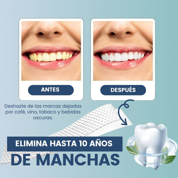 WhiteStrips™ Kit de Tiras de Blanqueamiento de Dientes x14