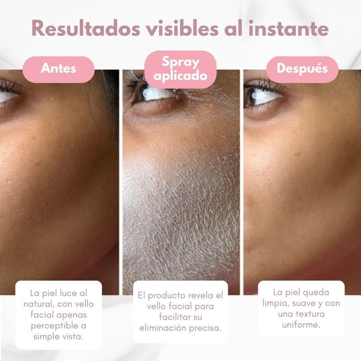Lumine® Spray identificador de vello + Kit de dermaplanners gratis