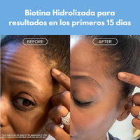 Recovfit® Colágeno Hidrolizado a Base de Biotina