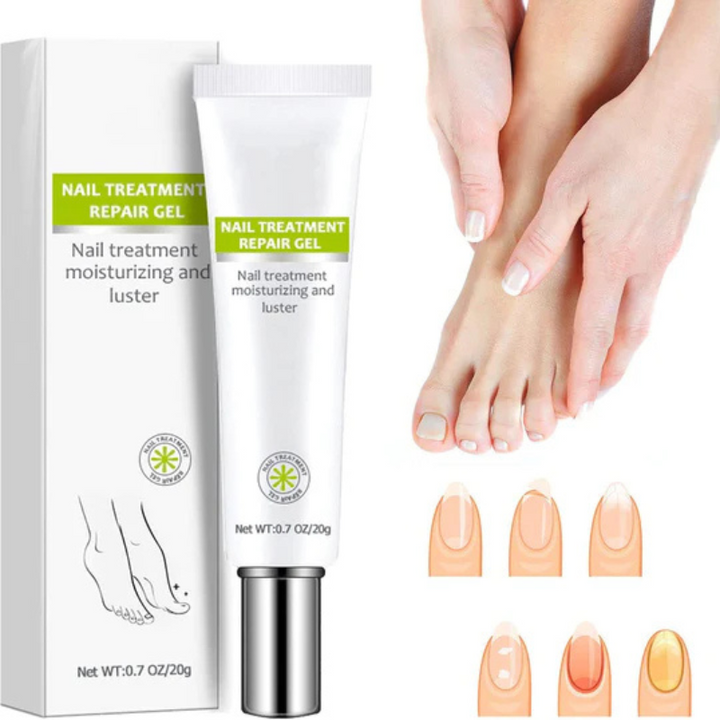 Fungi® Tratamiento Revitalizante De Uñas