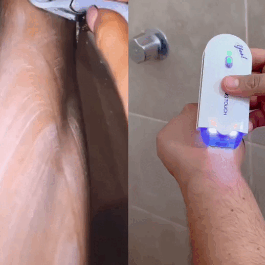 HiBeauty® Depiladora Led de Microoscilación – Homexpress